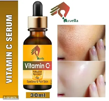 Auvella Vitamin C Professional  Night  Day Revitalizing Brightening Facial Serum 30 ML-thumb0